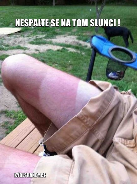 Nespalte se na tom slunci!